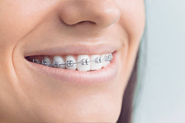 Best Invisalign and Clear Aligners  in Mineville, NY